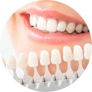 ホワイトニングの明るさを示すシェードの画像